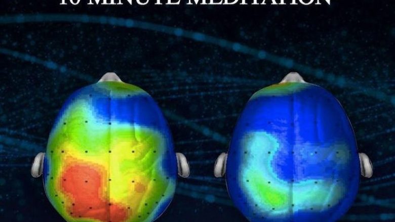 Neuroshkencëtarët e zbulojnë KËNGËN e cila e zvogëlon SHQETËSIMIN për 65 për qind (Audio)