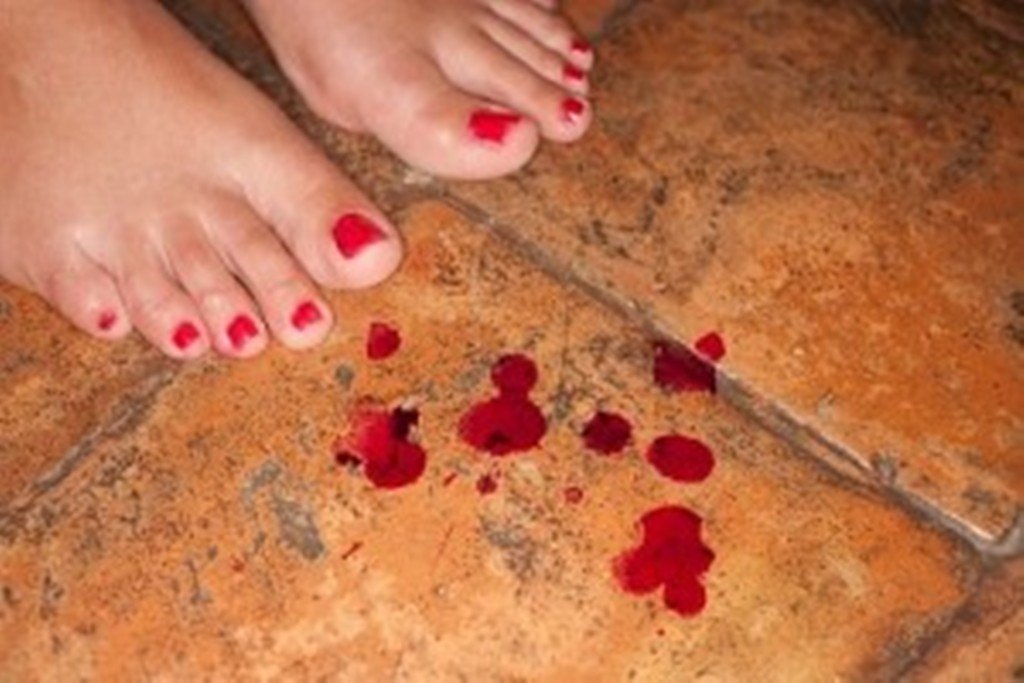 Teeners fucing blood bleeding pics