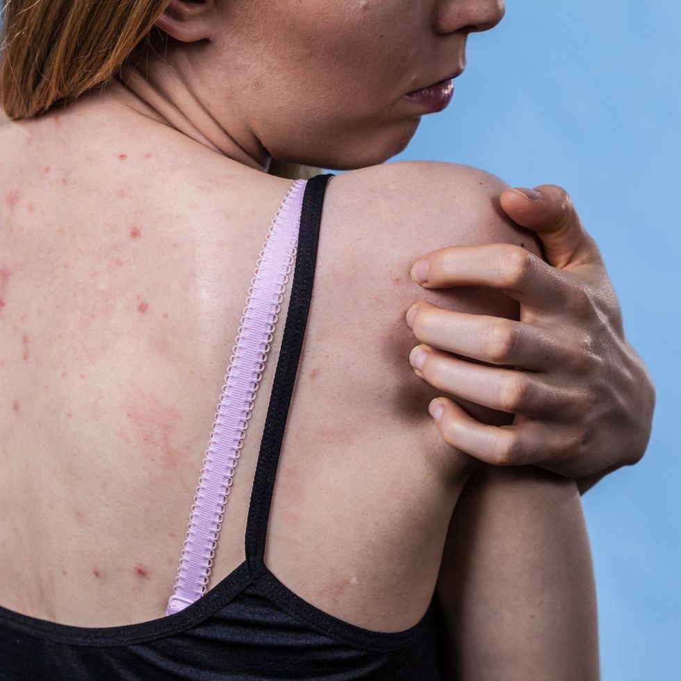 0 GettyImages 1024825434 1