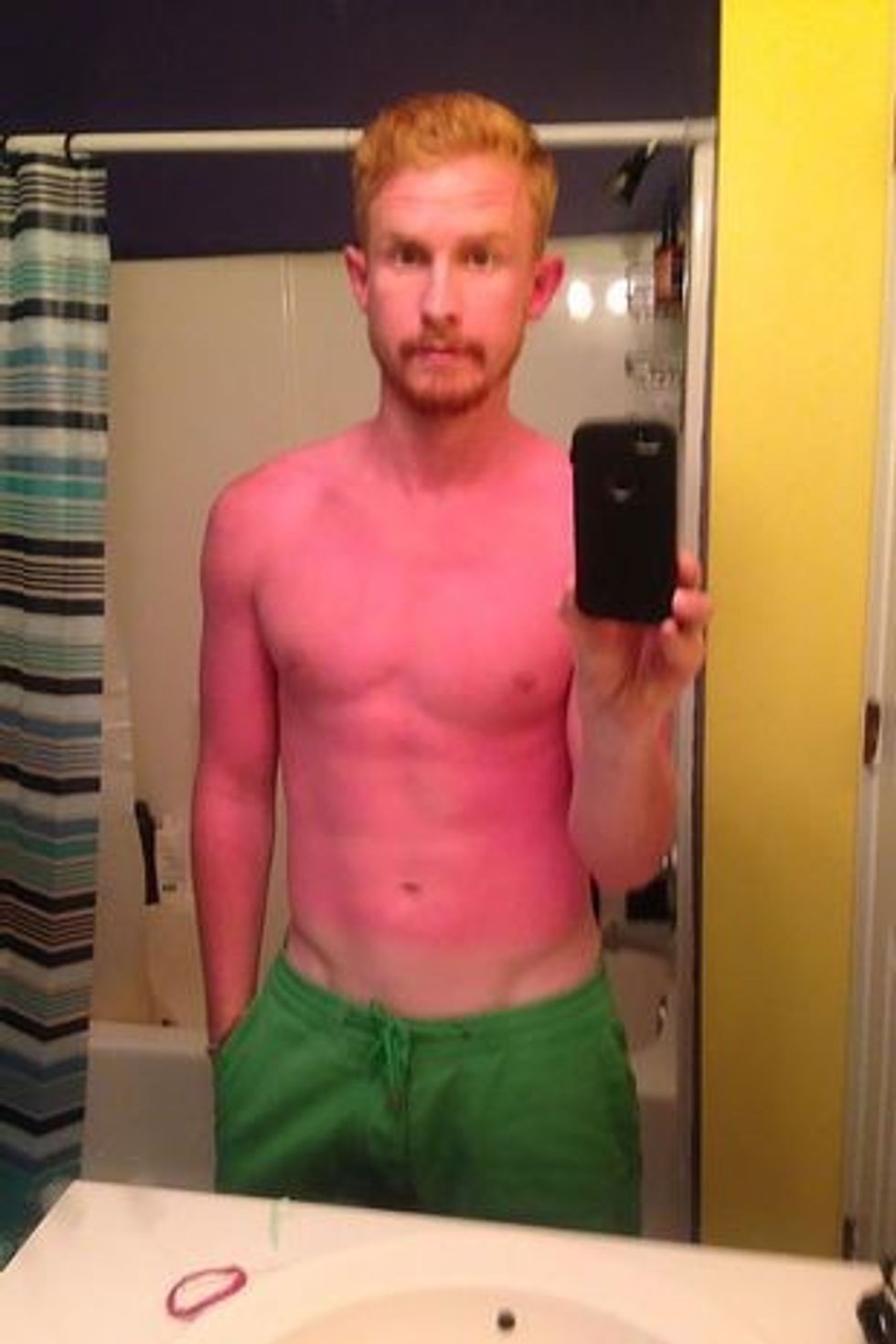 0 PAY BURN BABY BURN 2
