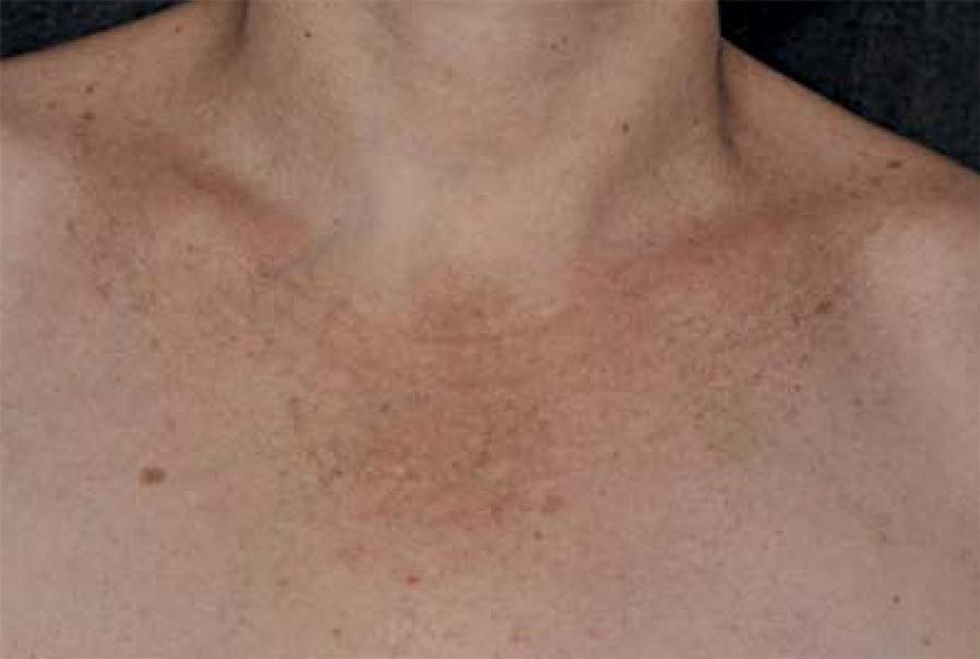 0365 0596 abd 89 05 0771 gf02