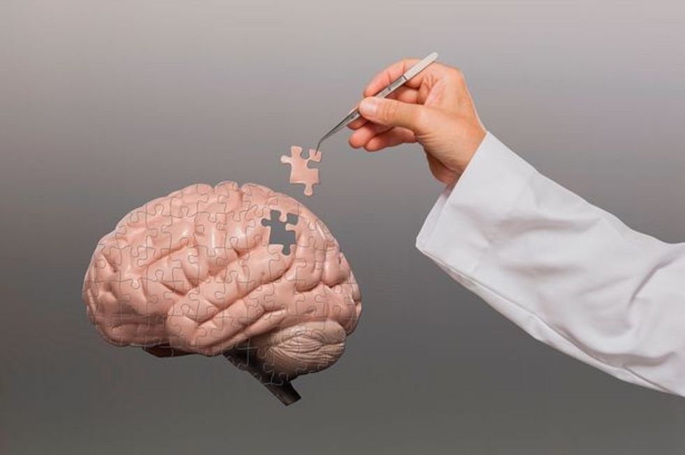 1 Doctor putting brain puzzle together