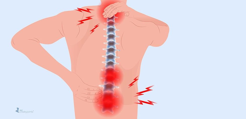 1019 Arthritis in Back Logo