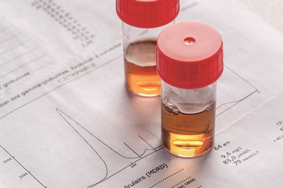 1070164 urine test and results 16