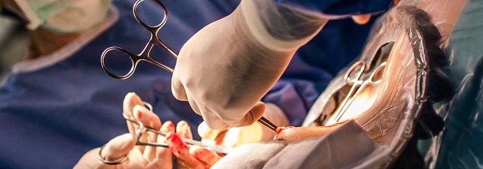 11 secrets you need to know about having a c section