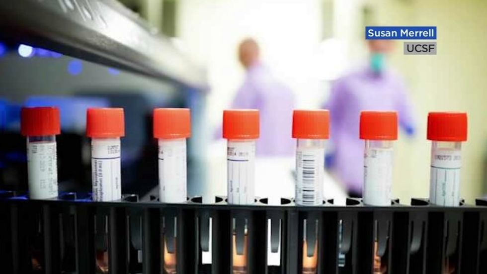 11290844 120121 kgo omicron img