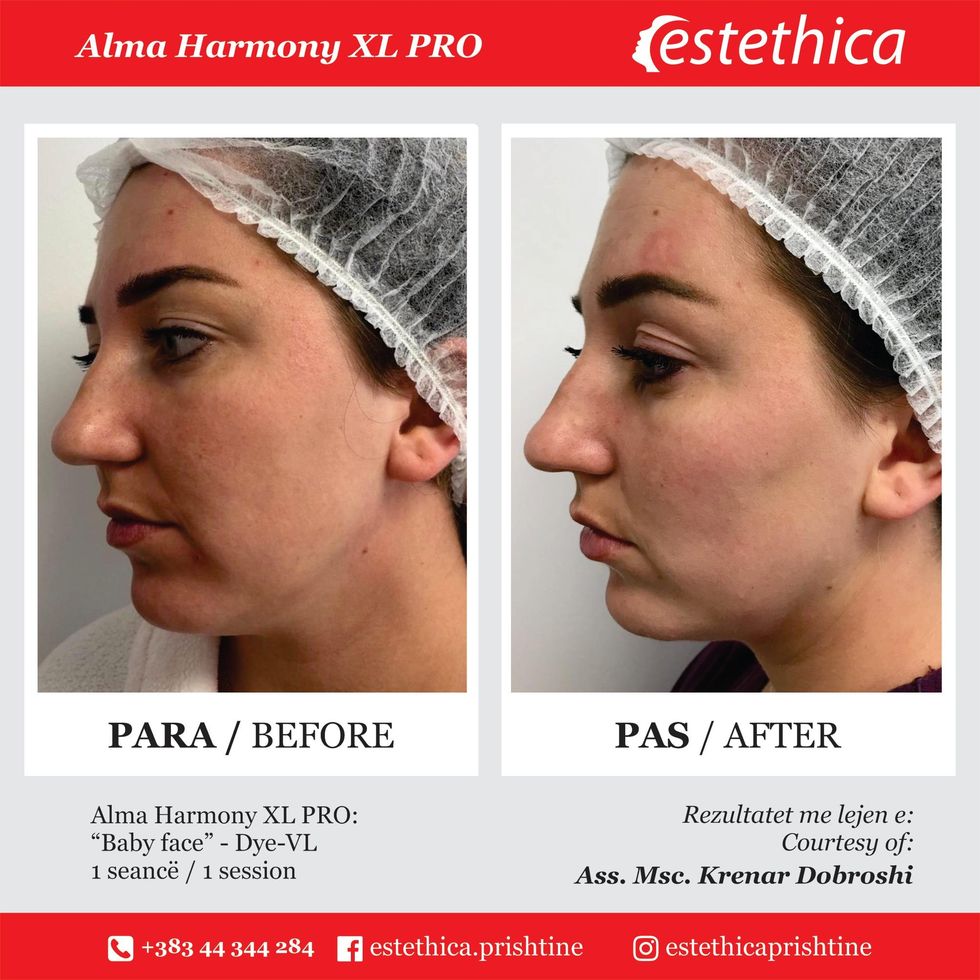 122549700 265418878212845 4217225416256032435 n