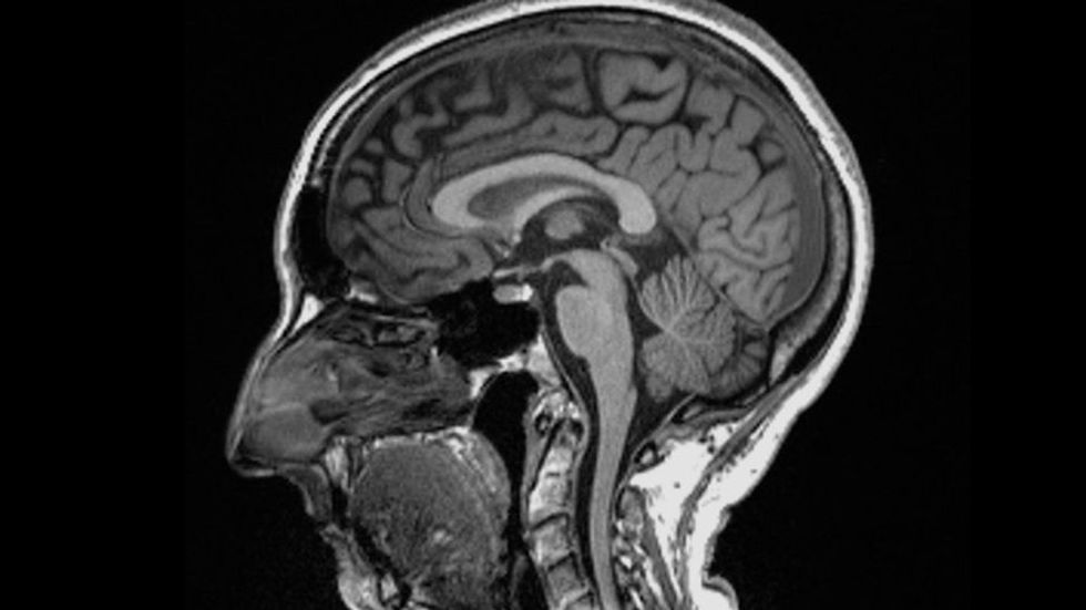 123482414 scanningimage1