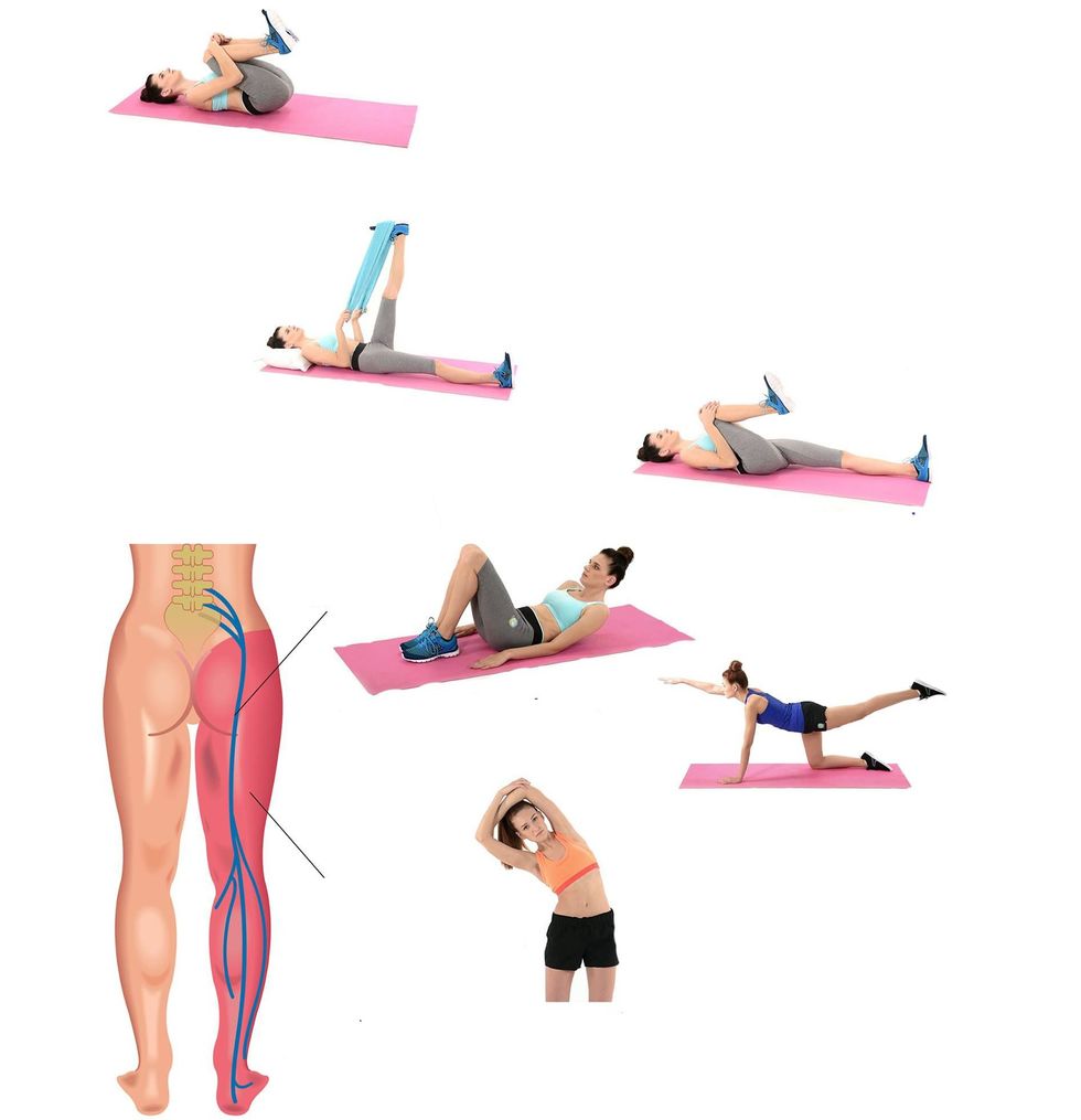 133217902 vector illustration of a exercises sciatica