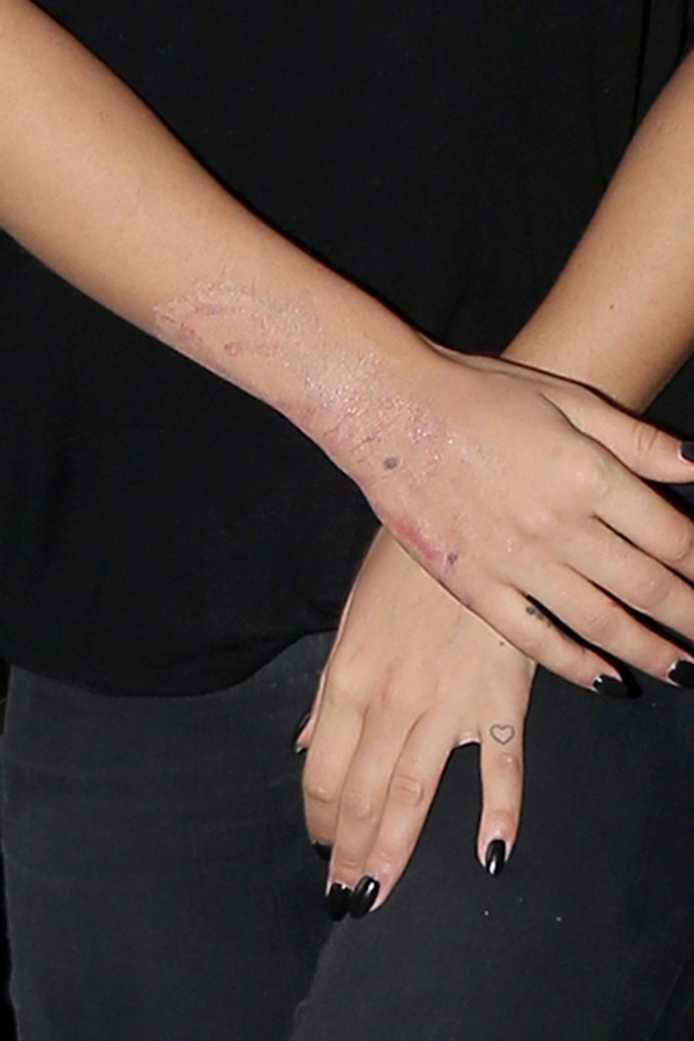 16.August.2016 - New York � USA **STRICTLY AVAILABLE FOR UK AND GERMANY USE ONLY** New York, NY - Rita Ora is seen arriving to an office building on Tuesday afternoon. The 25-year-old singer is crosses her arms as she exits the car revealing a mystery skin condition. Rita keeps her head down wearing all black as she heads inside. BYLINE MUST READ : AKM-GSI-XPOSURE ***UK CLIENTS - PICTURES CONTAINING CHILDREN PLEASE PIXELATE FACE PRIOR TO PUBLICATION *** *UK CLIENTS MUST CALL PRIOR TO TV OR ONLINE USAGE PLEASE TELEPHONE 0208 344 2007*