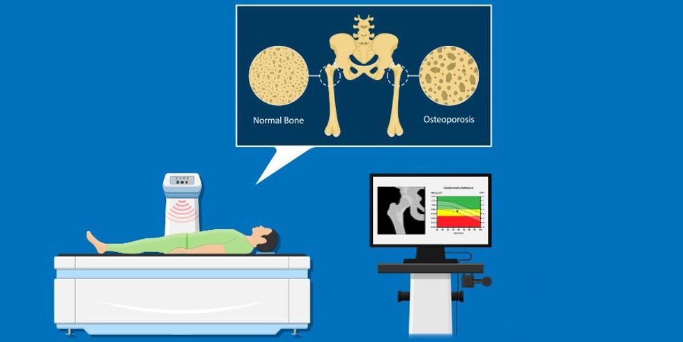 1620186006 Bone big 1
