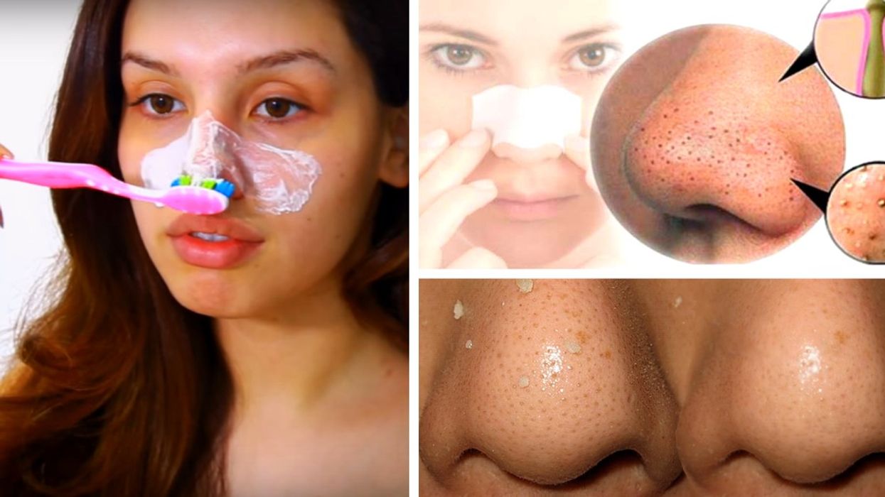 2016/09/How-She-Gets-Rid-Of-Her-Blackheads-With-a-DIY-Mask-and-Toothbrush-is-Simply-Amazing.jpg