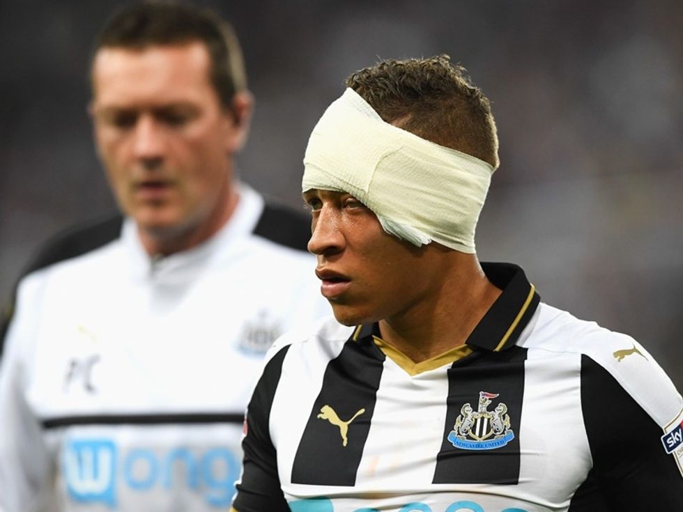 2016/11/Dwight-Gayle.jpg