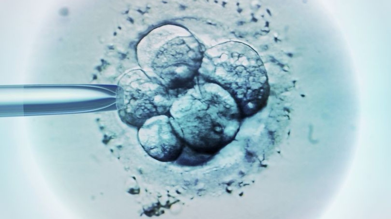 2016/12/Embryo-selection-for-IVF-light-micrograph.jpg