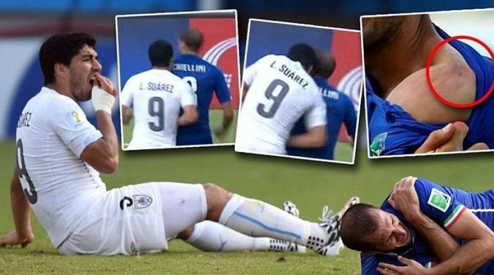 2017/05/gest-socant-uruguayanul-suarez-l-a-muscat-pe-italianul-chiellini-de-umar-nu-este-prima-victima-a-a-d6urvE.jpg