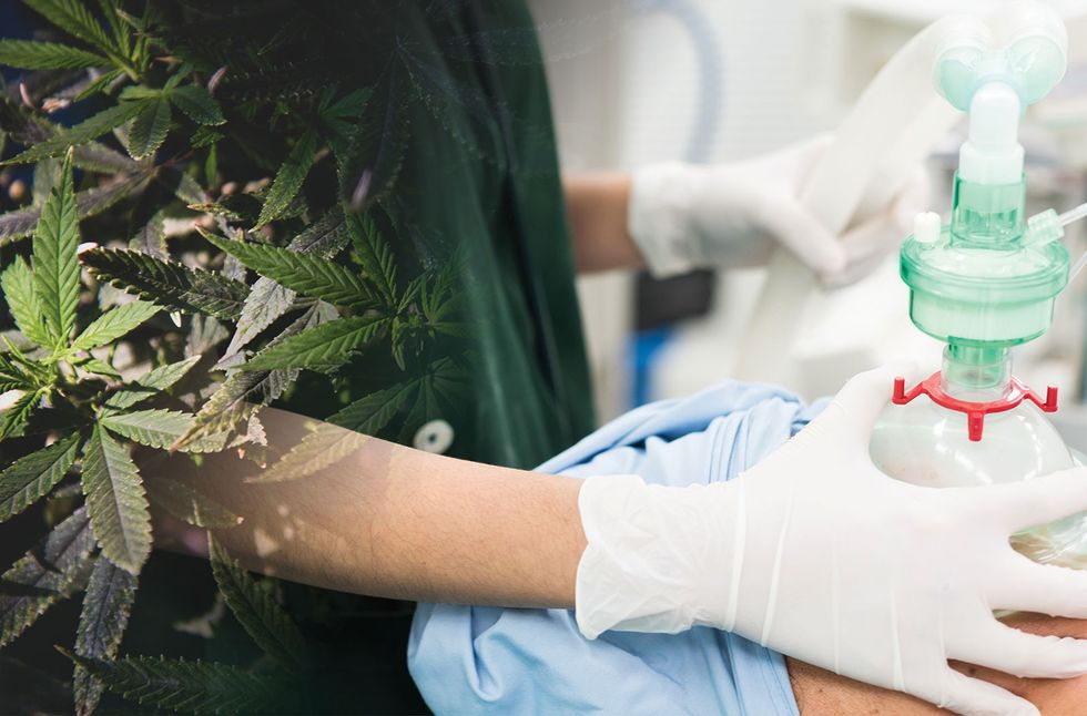 2018/03/cannabis-anesthesia.jpg
