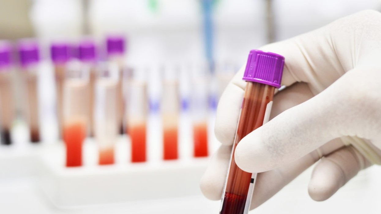 2018/08/health-wellness_body-mind-spirit_cancer_a-blood-test-for-breast-cancer_1440x1080_538527489-1024x768.jpeg