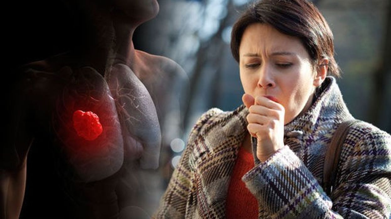 2019/04/Lung-cancer-symptoms-Is-your-cough-a-lung-cancer-cough-Look-out-for-these-three-signs-1017628.jpg
