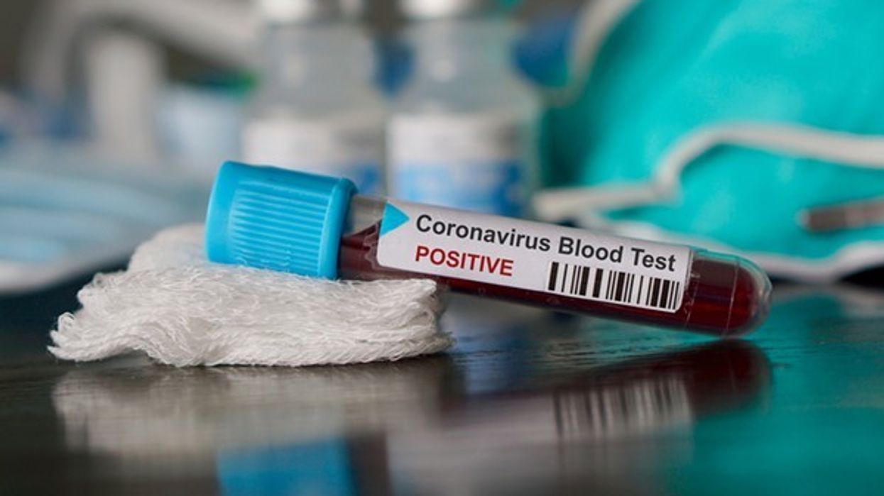 2020/03/coronavirus_shutterstock.jpg