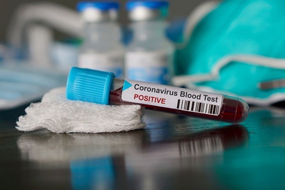 2020/03/coronavirus_shutterstock.jpg