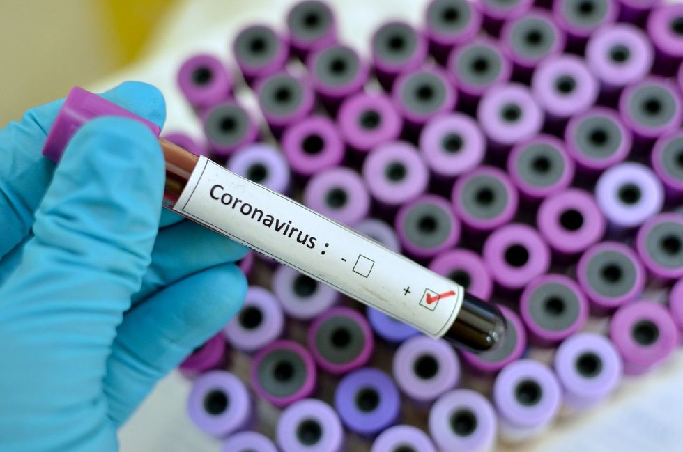 2020/03/Coronavirus2.jpg