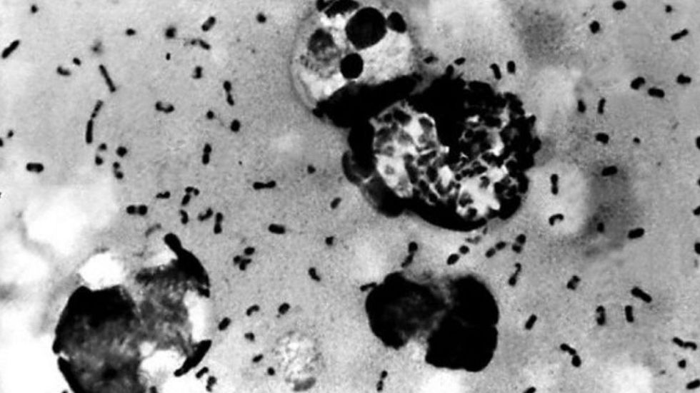 2020/08/fed8089e-bubonic-plague-cdc-1.jpg