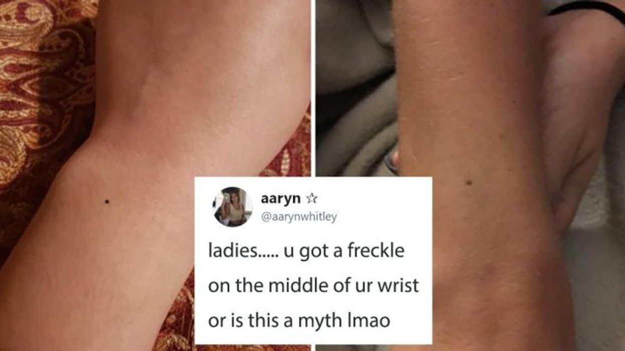 2020/11/women-are-realizing-they-all-have-the-same-freckle-on-their-wrist-768x402-1.jpg