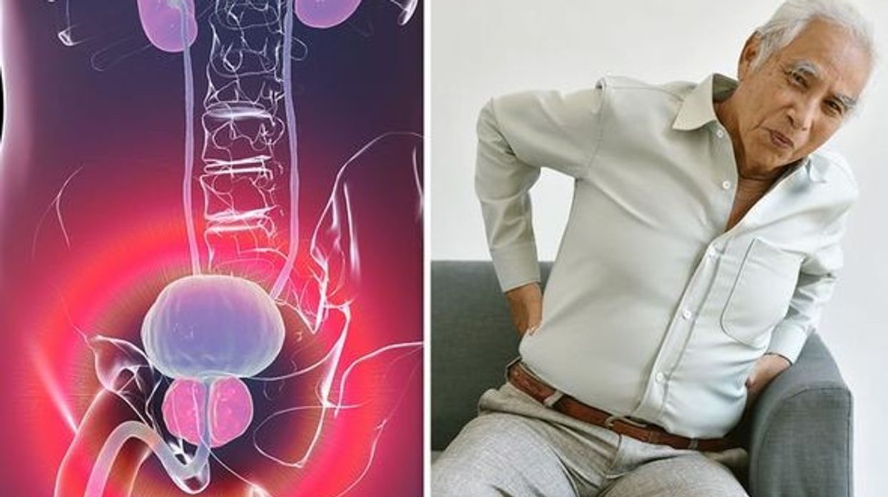 2021/02/Prostate-cancer-symptoms-Pain-in-unexpected-body-parts-might-occur-1397769-1.jpg