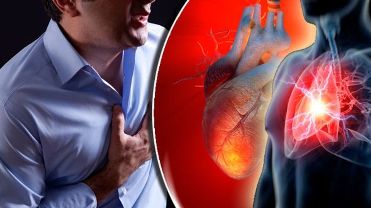 2021/03/Heart-attack-Experts-believe-a-test-could-see-if-people-are-at-risk-of-heart-attack-828565.jpg