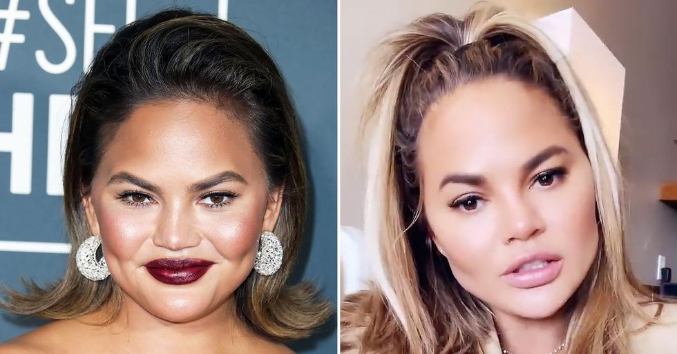 2021/09/chrissy-teigen-surgery-fat-removal-cheeks-ok-1631629612165.jpg
