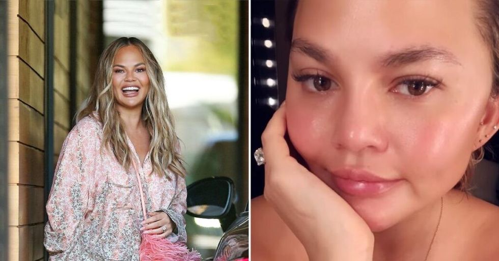 2021/12/chrissy-teigen-new-eyebrows-transplants-fat-removal-cheeks-husband-john-legend-pp-1640806128632-1024x536-1.jpg