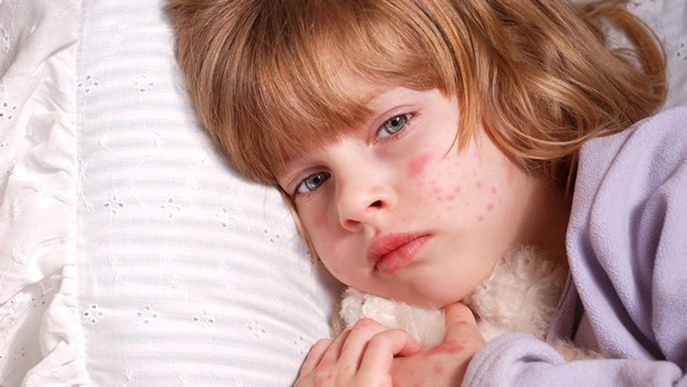 2022/03/Does-my-child-need-treatment-for-their-rash.jpg