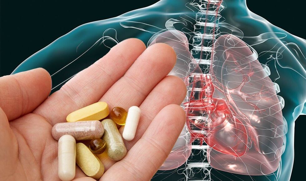 2022/05/cancer-warning-three-vitamin-supplements-linked-to-an-elevated-risk-of-lung-cancer.jpg