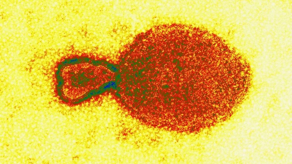 2022/08/Henipavirus-Hendra-Virus-1200x675-1.jpg