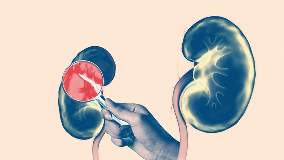 2022/12/kindney-disease-causes-GettyImages-12.jpg