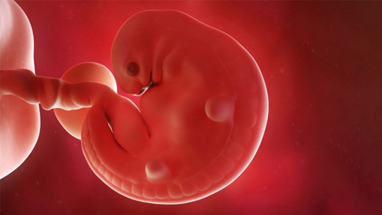 2023/07/6-week-old-fetus.jpg
