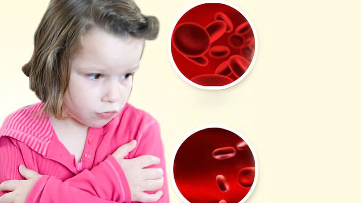 2024/01/anemia-in-children.jpg