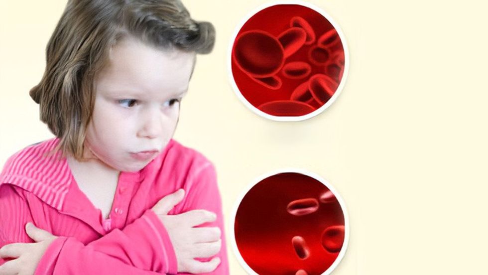 2024/01/anemia-in-children.jpg