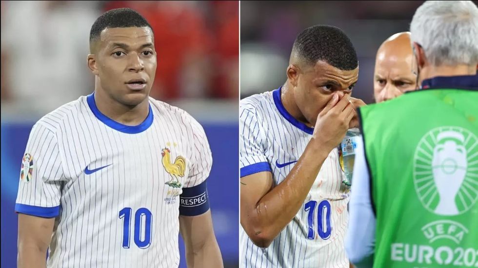2024/06/mbappe-euro-2024-1.jpg