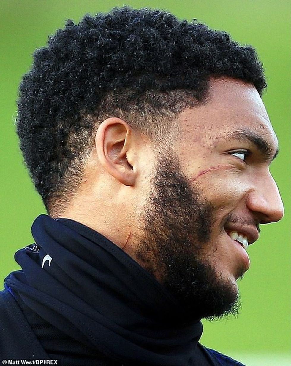 20955896 7680601 A close up of Joe Gomez s face reveals a huge scar that extends m 13 1573652080116