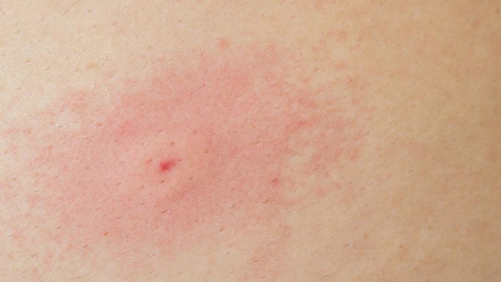 2159225 shutterstock 1098807863 ff