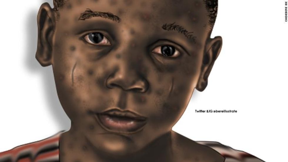 220110171746 restricted chidiebere medical illustration 3 exlarge 169