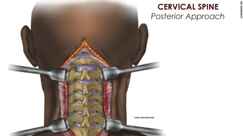 220113084812 restricted chidiebere medical illustration 5 2 exlarge 169