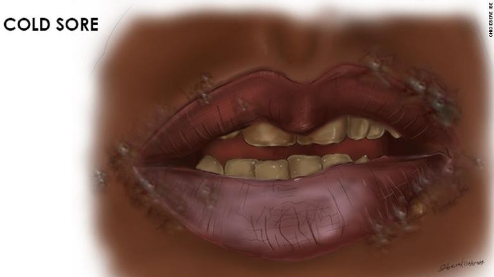 220113084816 restricted chidiebere medical illustration 6 2 exlarge 169