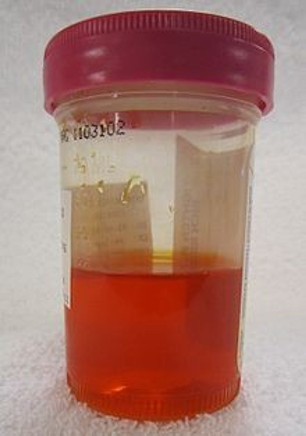 220px Pyridiumurine