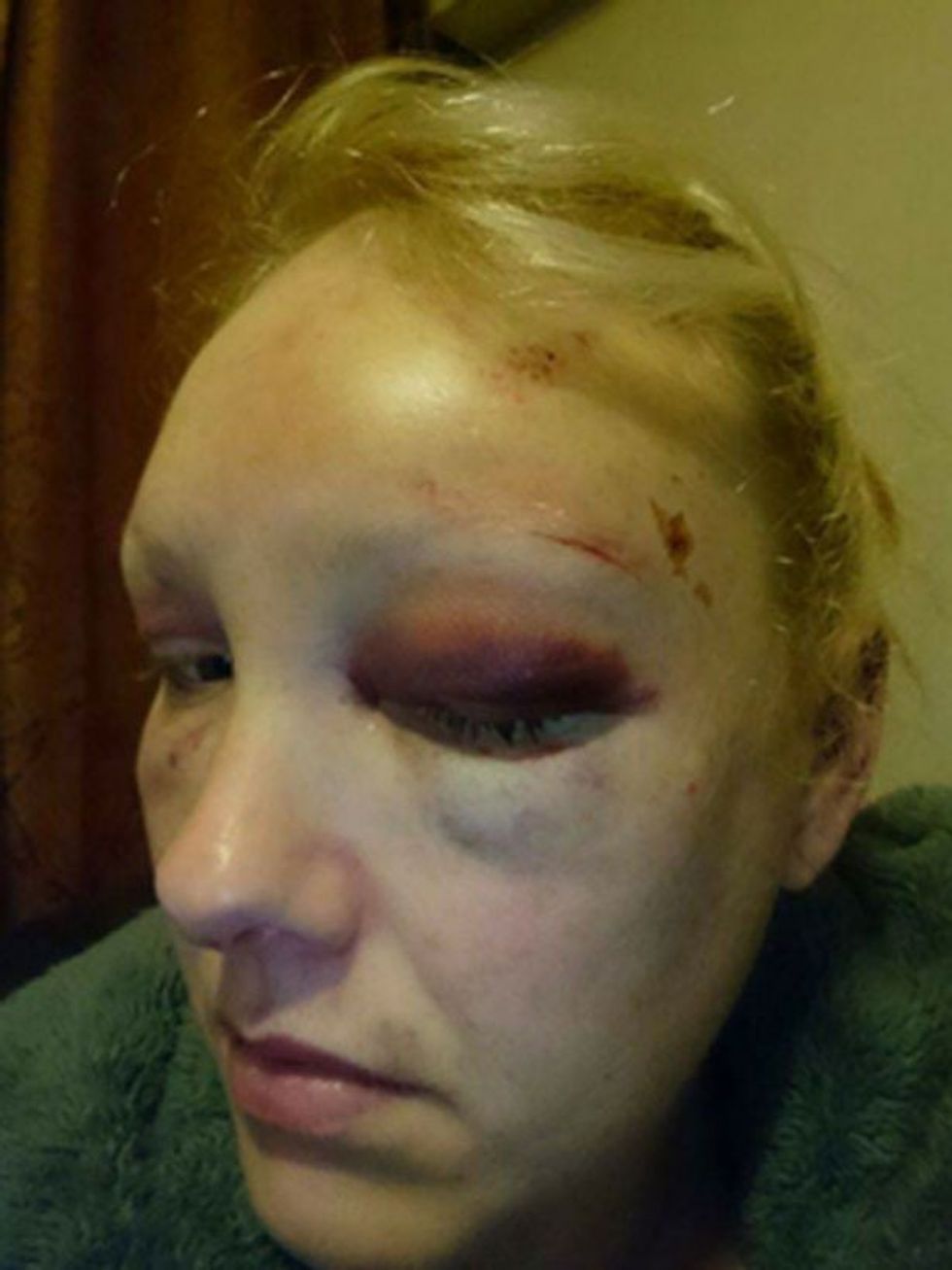 222 6