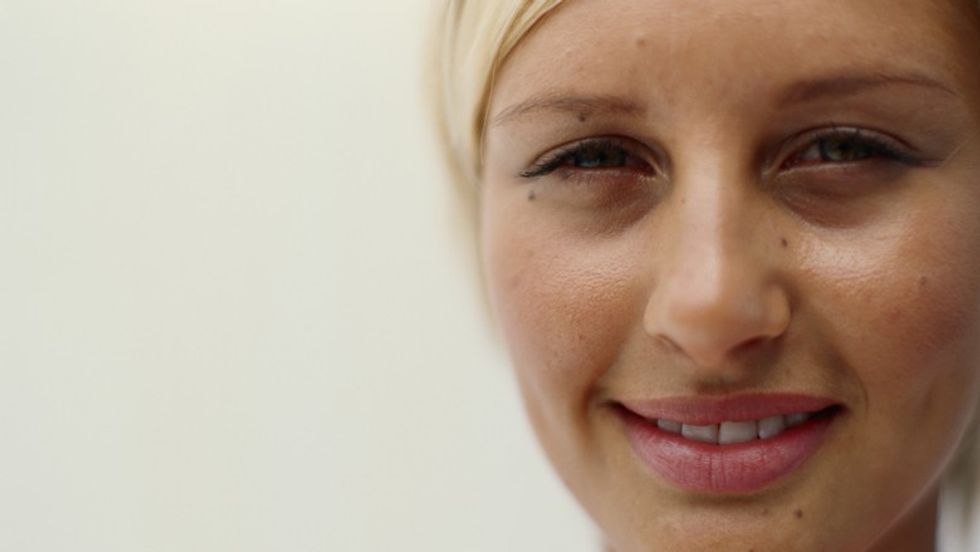 226538 Young woman with moles on face