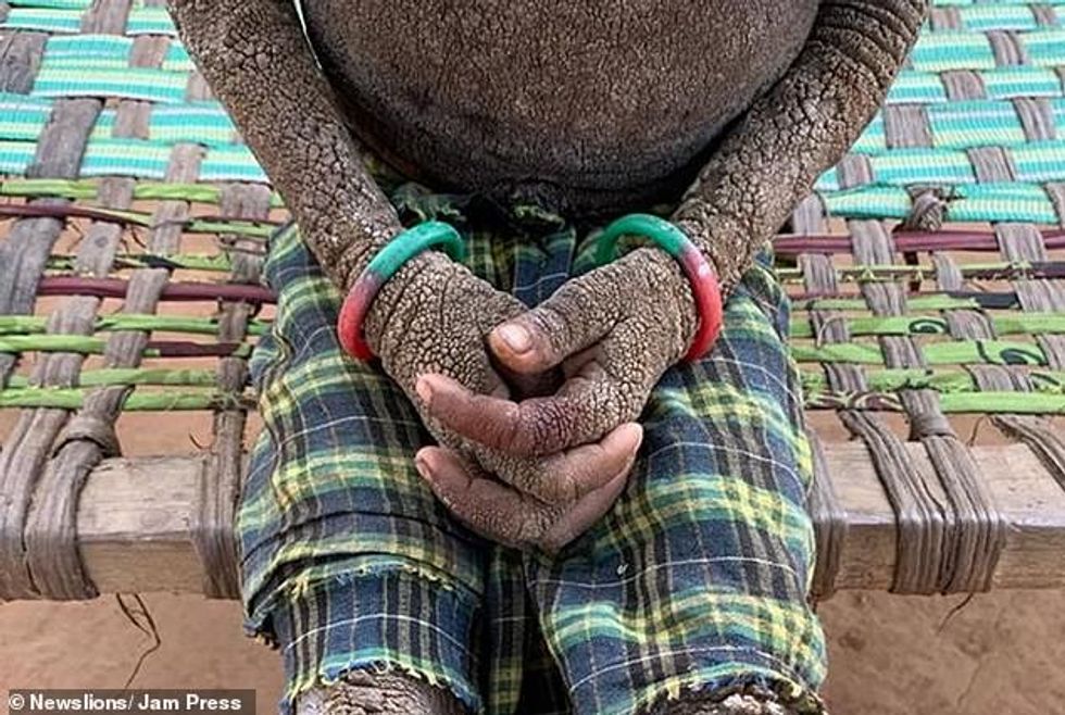 24387184 7973289 The condition a 6 1580985268028