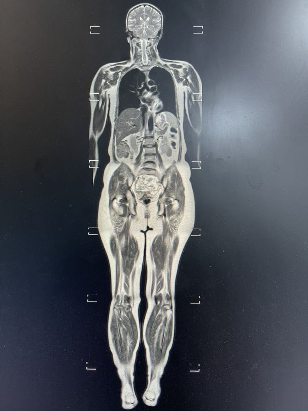 2563a670 2a5c 4f5e a6f2