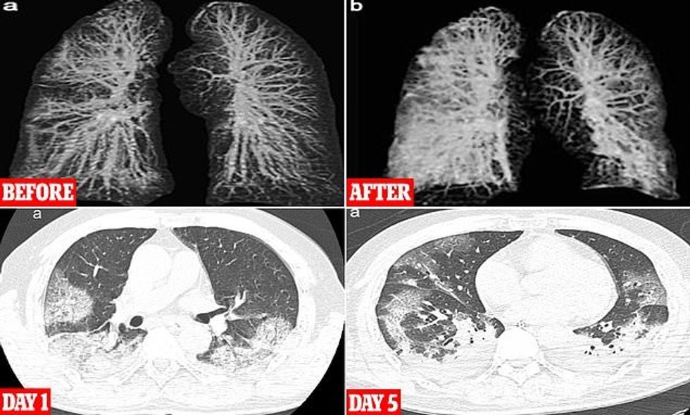 26034790 0 image a 28 1584374024187